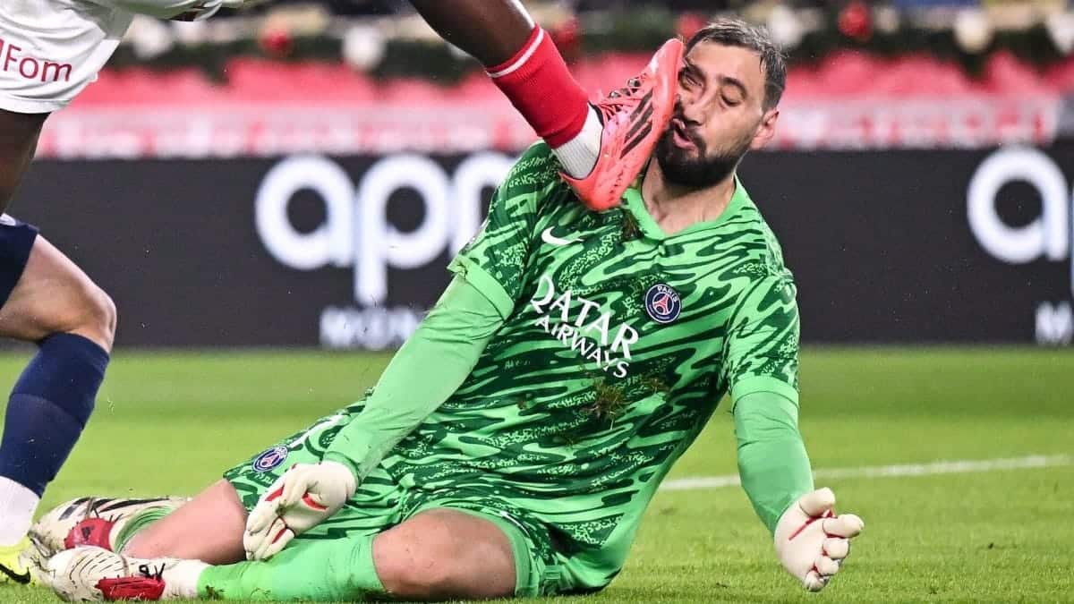 How did Gianluigi Donnarumma get his facial scar?